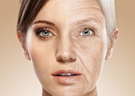 prije i poslije laserskog pomlađivanja kože lica